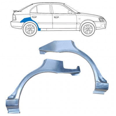 HYUNDAI ACCENT 2000-2006 5 TÜR RADLAUF REPARATURBLECH / SATZ