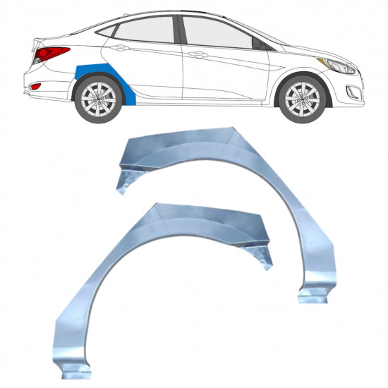 Reparaturblech Kotflügel hinten für Hyundai Accent 2010- / Links / Rechts / Links / Rechts 12804